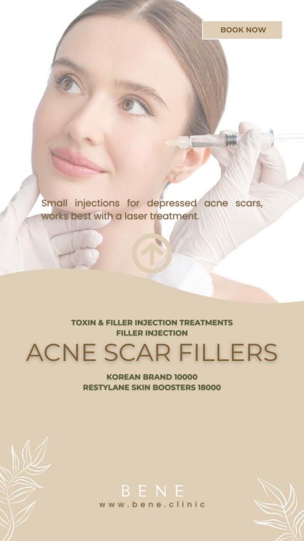 ACNE SCAR FILLERS