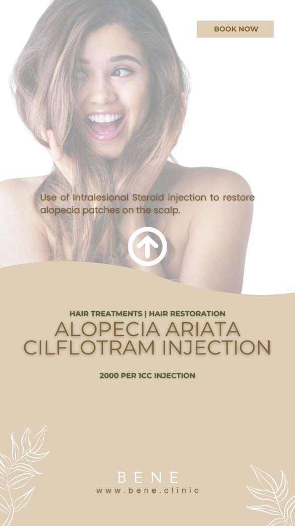 ALOPECIA ARIATA CILFLOTRAM INJECTION​