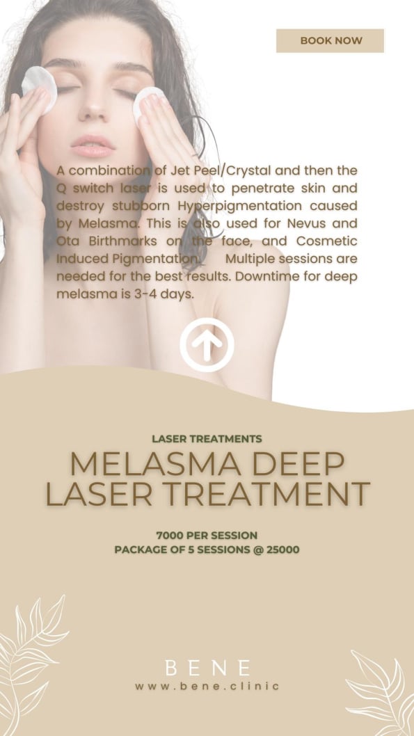 MELASMA DEEP LASER TREATMENT