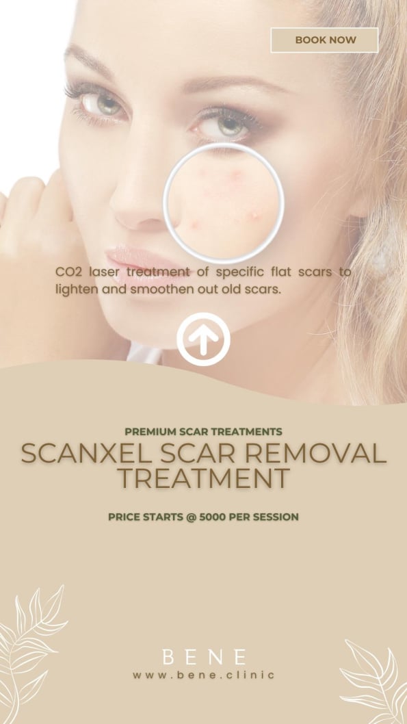 SCANXEL SCAR REMOVAL TREATMENT