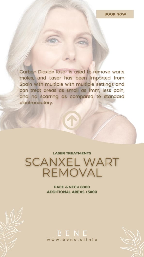 SCANXEL WART REMOVAL