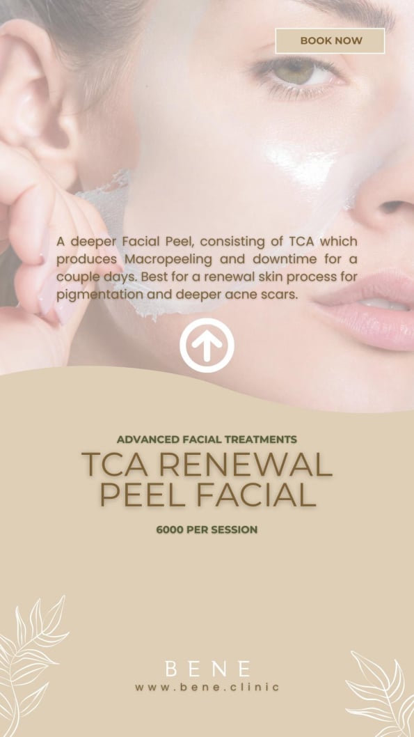 TCA RENEWAL PEEL FACIAL