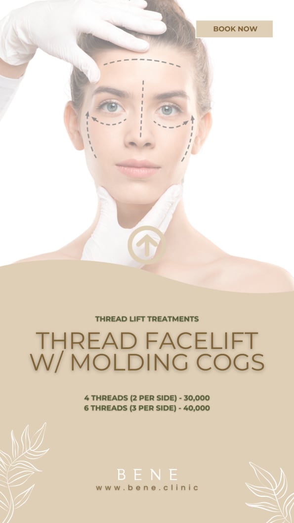 THREAD FACELIFT W MOLDING COGS